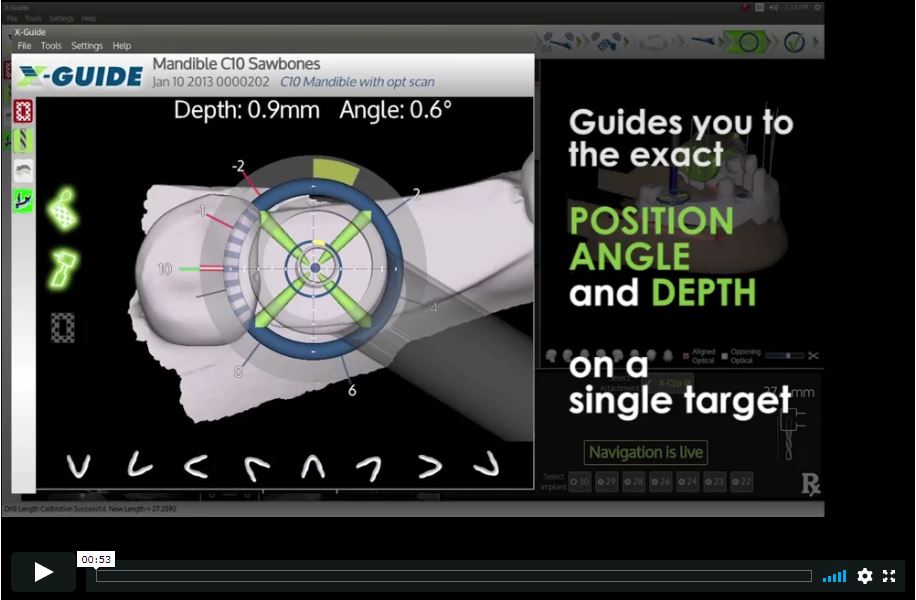 X-Guide Video
